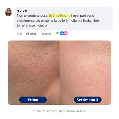 Maschera all'argilla Coreana - efficace contro i punti neri e per la pulizia dei pori.