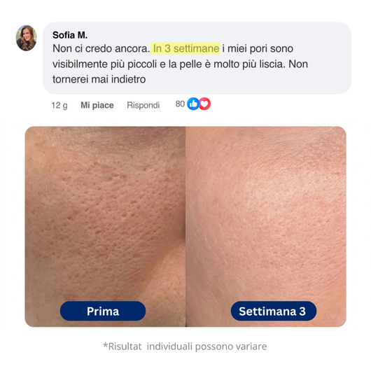 Maschera all'argilla Coreana - efficace contro i punti neri e per la pulizia dei pori.