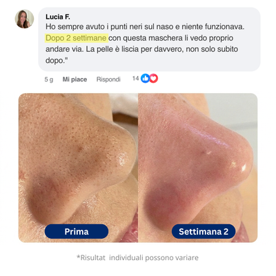 Maschera all'argilla Coreana - efficace contro i punti neri e per la pulizia dei pori.