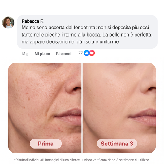 Luvisea NAD+ Serum - Riduce le linee dell'età e migliora l'elasticità