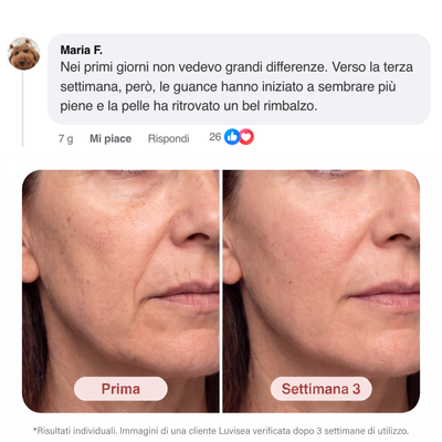 Luvisea NAD+ Serum - Riduce le linee dell'età e migliora l'elasticità